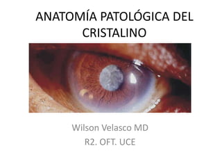 ANATOMÍA PATOLÓGICA DEL
CRISTALINO
Wilson Velasco MD
R2. OFT. UCE
 