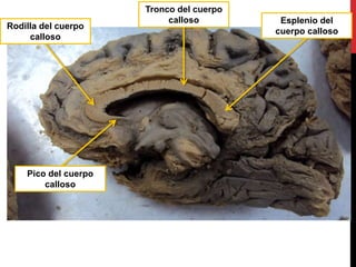 Esplenio del
cuerpo calloso
Tronco del cuerpo
calloso
Rodilla del cuerpo
calloso
Pico del cuerpo
calloso
 