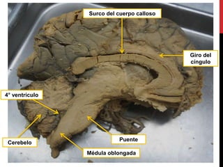 Cerebelo
Puente
Médula oblongada
4° ventrículo
Giro del
cíngulo
Surco del cuerpo calloso
 