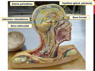 Arteria pericallosa
Seno esfenoidal
Hipófisis (glánd. pituitaria)
Adhesión intertalámica
Seno frontal
 