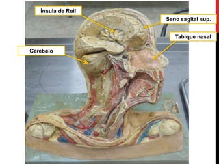 Tabique nasal
Seno sagital sup.
Cerebelo
Ínsula de Reil
 
