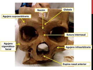 Agujero supraorbitrario
GlabelaNasión
Sutura internasal
Espina nasal anterior
Agujero
cigomático-
facial
Agujero infraorbitrario
 