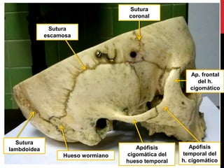 Hueso wormiano
Sutura
lambdoidea
Sutura
escamosa
Sutura
coronal
Apófisis
cigomática del
hueso temporal
Apófisis
temporal del
h. cigomático
Ap. frontal
del h.
cigomático
 