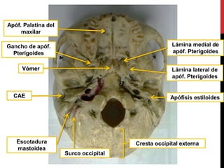 Escotadura
mastoidea
Surco occipital
CAE Apófisis estiloides
Cresta occipital externa
Vómer
Lámina medial de
apóf. Pterigoides
Lámina lateral de
apóf. Pterigoides
Gancho de apóf.
Pterigoides
Apóf. Palatina del
maxilar
 