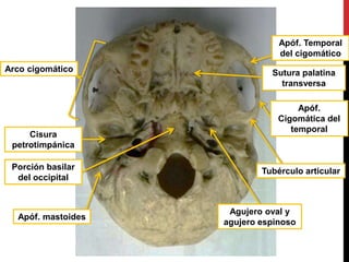 Arco cigomático
Apóf. Temporal
del cigomático
Apóf.
Cigomática del
temporal
Porción basilar
del occipital
Sutura palatina
transversa
Agujero oval y
agujero espinoso
Apóf. mastoides
Cisura
petrotimpánica
Tubérculo articular
 