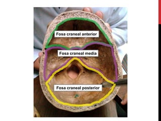 Fosa craneal anterior
Fosa craneal media
Fosa craneal posterior
 