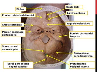 Crista Galli
Lámina cribosa
Diploe
Cresta esfenoidal
Porción petrosa del
temporal
Porción orbitaria del frontal
Surco para el
seno transverso
Protuberancia
occipital interna
Surco para el
seno occipital
Surco para el seno
sagital superior
Porción escamosa
del temporal
Yugo del esfenoides
 