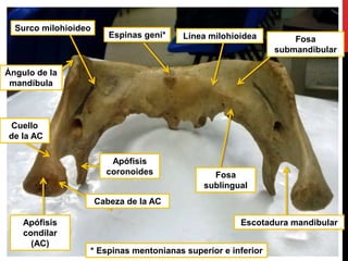 Escotadura mandibular
Fosa
submandibular
Fosa
sublingual
Línea milohioideaEspinas geni*
* Espinas mentonianas superior e inferior
Apófisis
coronoides
Apófisis
condilar
(AC)
Cabeza de la AC
Cuello
de la AC
Surco milohioideo
Ángulo de la
mandíbula
 