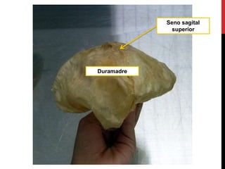 Duramadre
Seno sagital
superior
 