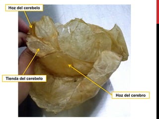 Tienda del cerebelo
Hoz del cerebelo
Hoz del cerebro
 