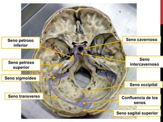 Seno cavernoso
Seno
intercavernoso
Seno occipital
Confluencia de los
senos
Seno sagital superior
Seno petroso
superior
Seno sigmoideo
Seno petroso
inferior
Seno transverso
 