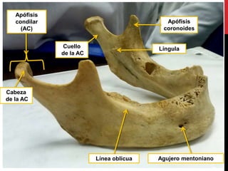 Línea oblicua Agujero mentoniano
Apófisis
condilar
(AC)
Cabeza
de la AC
Apófisis
coronoides
Cuello
de la AC
Língula
 