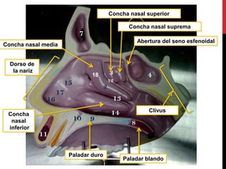 18
Abertura del seno esfenoidal
Paladar duro
Concha
nasal
inferior
Concha nasal media
Concha nasal suprema
Concha nasal superior
Dorso de
la nariz
Paladar blando
Clivus
 