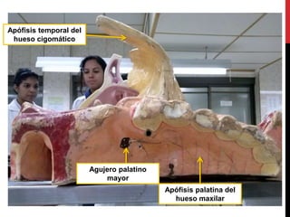 Apófisis temporal del
hueso cigomático
Apófisis palatina del
hueso maxilar
Agujero palatino
mayor
 