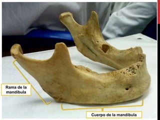 Rama de la
mandíbula
Cuerpo de la mandíbula
 