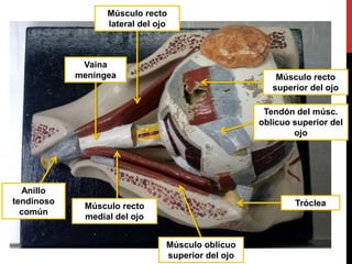 Músculo recto
superior del ojo
Tendón del músc.
oblicuo superior del
ojo
Músculo recto
lateral del ojo
Tróclea
Músculo oblicuo
superior del ojo
Músculo recto
medial del ojo
Vaina
meníngea
Anillo
tendinoso
común
 