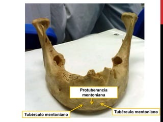 Tubérculo mentoniano
Tubérculo mentoniano
Protuberancia
mentoniana
 