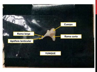 YUNQUE
Apófisis lenticular
Rama larga
Rama corta
Cuerpo
 