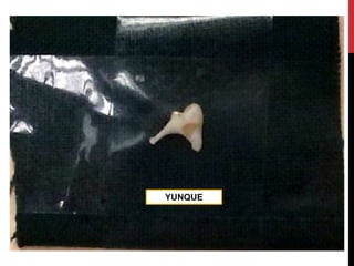 YUNQUE
 