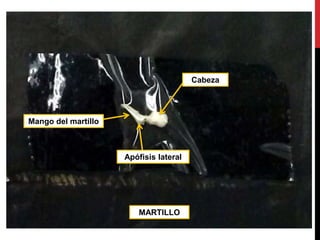 MARTILLO
Mango del martillo
Apófisis lateral
Cabeza
 