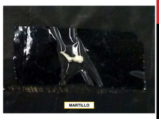 MARTILLO
 