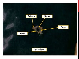 ESTRÍBO
Cabeza
Rama
Rama
Base
 