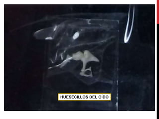 HUESECILLOS DEL OÍDO
 