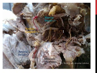 Anatomía (práctico de cabeza)