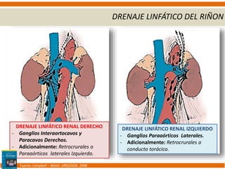 ANATOMÍA QUIRÚRGICA DE RIÑÓN, URÉTER Y VEJIGA URINARIA. JESSE JIMÉNEZ ...