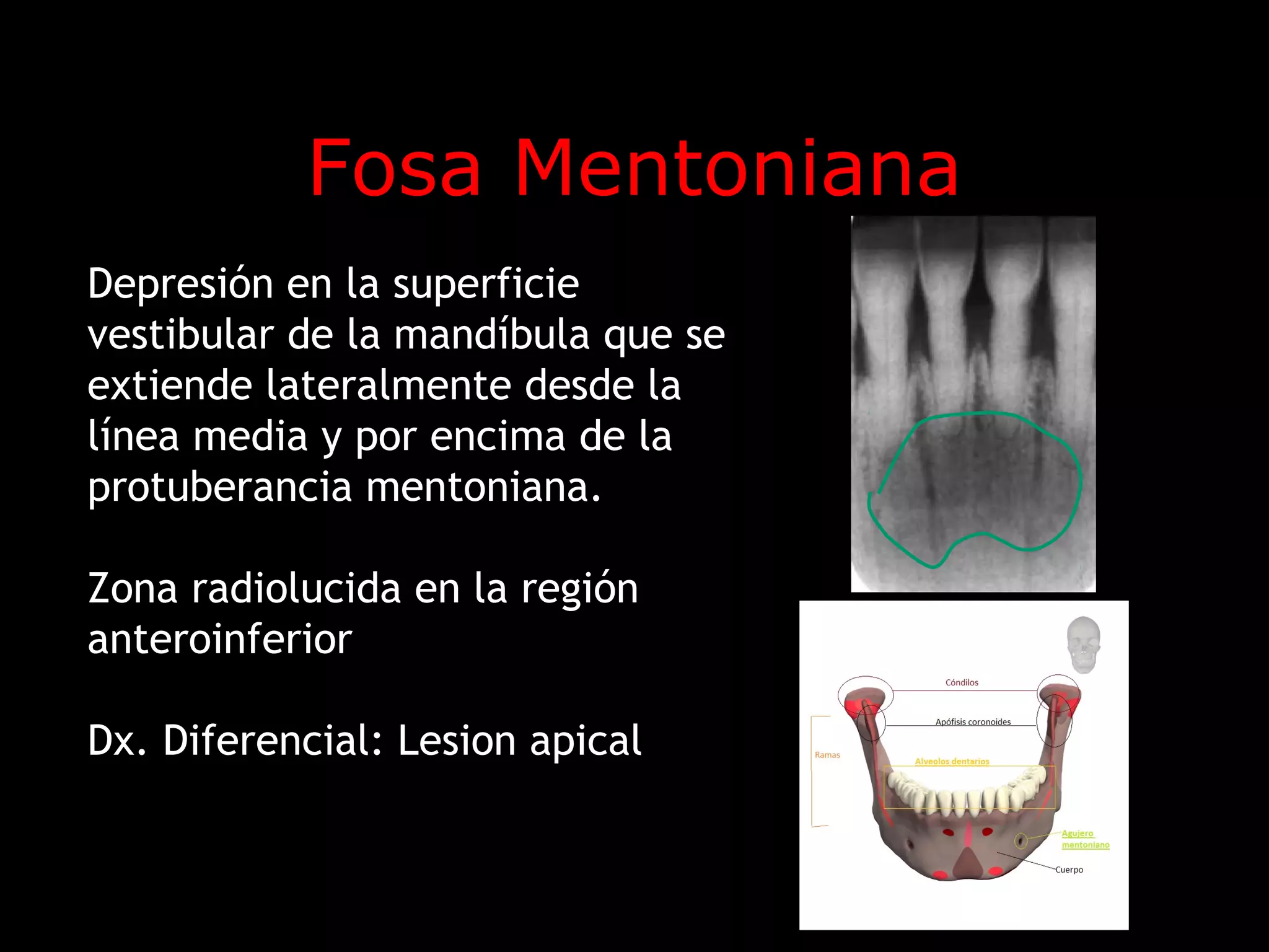 Anatomía radiográfica normal maxilar superior | PPT