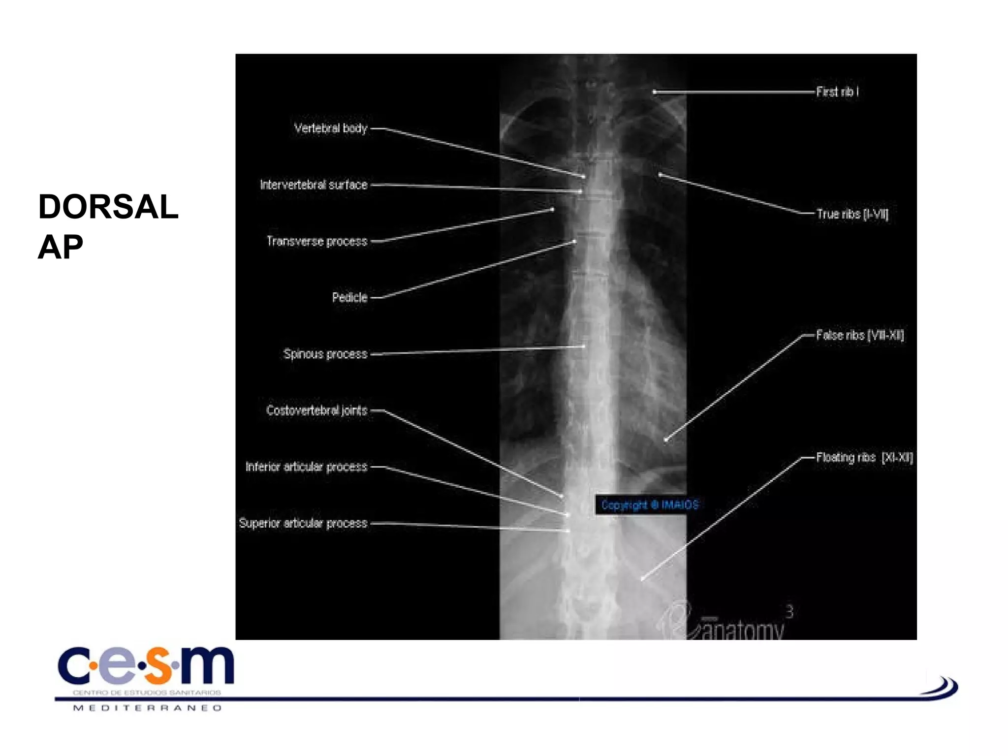 Anatomía radiológica de la columna vertebral | PPT