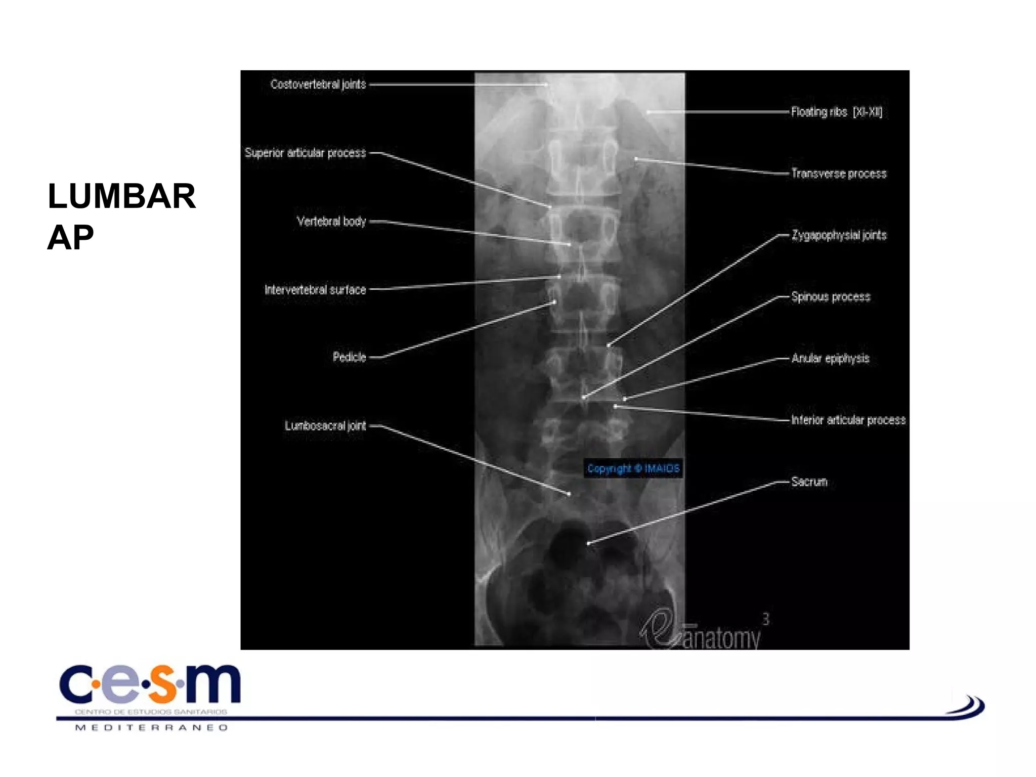 Anatomía radiológica de la columna vertebral | PPT