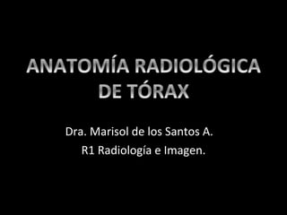 Dra. Marisol de los Santos A.  R1 Radiología e Imagen. 