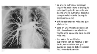 CALIDAD:
 Vértices pulmonares deben aparecer sin
superposición de las clavículas
 Las clavículas deben estar en posición...