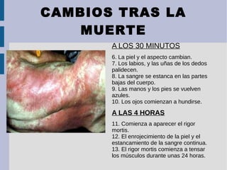 CAMBIOS TRAS LA
MUERTE
A LOS 30 MINUTOS
6. La piel y el aspecto cambian.
7. Los labios, y las uñas de los dedos
palidecen.
8. La sangre se estanca en las partes
bajas del cuerpo.
9. Las manos y los pies se vuelven
azules.
10. Los ojos comienzan a hundirse.
A LAS 4 HORAS
11. Comienza a aparecer el rigor
mortis.
12. El enrojecimiento de la piel y el
estancamiento de la sangre continua.
13. El rigor mortis comienza a tensar
los músculos durante unas 24 horas.
 