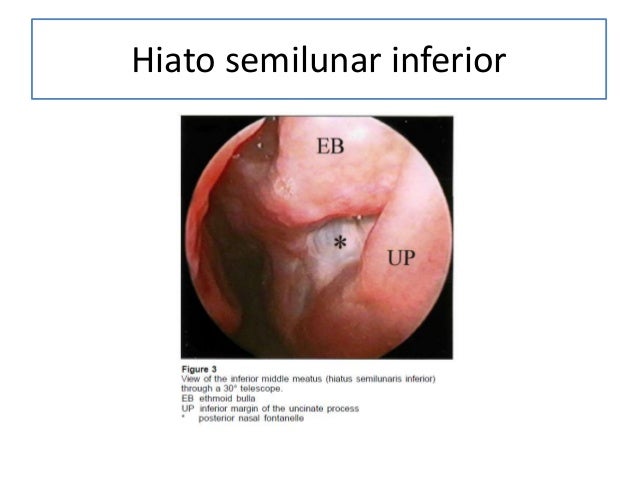 Anatomía senos paranasales