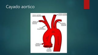 ANATOMÍA VASCULAR FINAL.pptx