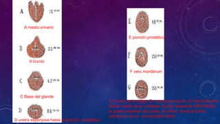 G Cuello de la vejiga. En consecuencia de la hipertrofia del
lóbulo medio de la próstata (úvula vesical de LIEUTAUD),
la pared posterior del cuello, el orificio toma la forma
semilunar con la concavidad inferior.
A meato urinario
B Glande
C Base del glande
D uretra esponjosa hasta la porción prostática.
E porción prostática
F veru montánum
 