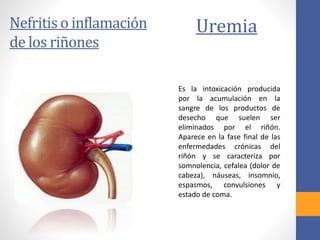 Nefritis o inflamación
de los riñones
Uremia
Es la intoxicación producida
por la acumulación en la
sangre de los productos de
desecho que suelen ser
eliminados por el riñón.
Aparece en la fase final de las
enfermedades crónicas del
riñón y se caracteriza por
somnolencia, cefalea (dolor de
cabeza), náuseas, insomnio,
espasmos, convulsiones y
estado de coma.
 