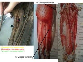 5 (amarelo)   m. adutor longo 6 (vermlho)    m. adutor curto 7 (verde)    m. adutor magno 1 2 3 4 7 5 6 7 m. Tensor da fáscia lata m. Bíceps femoral 