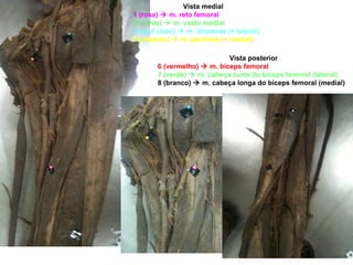 Vista medial 1 (rosa)    m. reto femoral 3 (verde)    m. vasto medial 4 (azul claro)    m. íliopsoas (+ lateral) 5 (amarelo)    m. pectíneo (+ medial) Vista posterior 6 (vermelho)    m. bíceps femoral 7 (verde)    m. cabeça curta do bíceps femoral (lateral) 8 (branco)    m. cabeça longa do bíceps femoral (medial)  