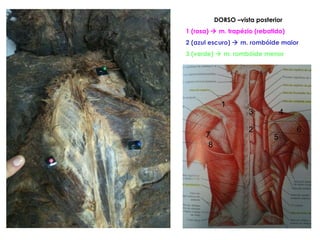 DORSO –vista posterior 1 (rosa)    m. trapézio (rebatido) 2 (azul escuro)    m. rombóide maior 3 (verde)    m. rombóide menor 1 3 2 4 5 6 8 7 