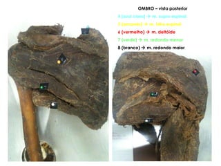 OMBRO – vista posterior 4 (azul claro)    m. supra espinal 5 (amarelo)    m. infra espinal 6 (vermelho)    m. deltóide 7 (verde)    m. redondo menor 8 (branco)    m. redondo maior 
