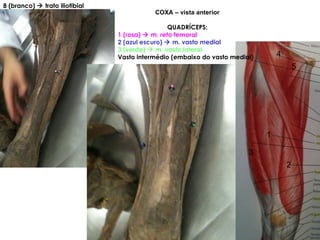 8 (branco)    trato iliotibial  COXA – vista anterior QUADRÍCEPS: 1 (rosa)    m. reto femoral 2 (azul escuro)    m. vasto medial 3 (verde)    m. vasto lateral Vasto intermédio (embaixo do vasto medial) 1 2 3 4 5 