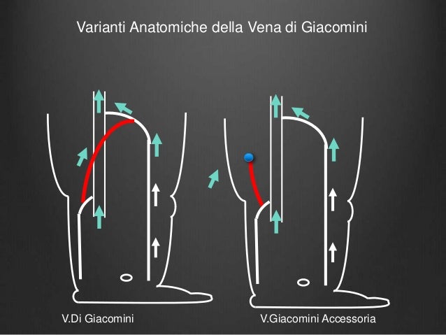 Segni di trombosi di arteria