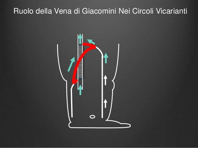La posizione di vene perché sono visibili