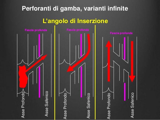 Unguento di gamba efficace a varicosity