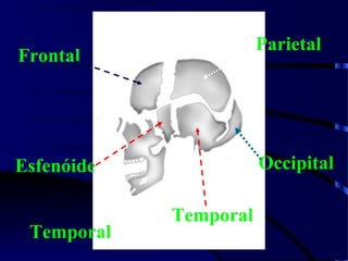 Frontal
Parietal
Temporal
Occipital
Temporal
Esfenóide
 