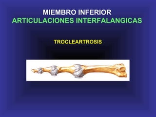 MIEMBRO INFERIOR
ARTICULACIONES INTERFALANGICAS
TROCLEARTROSIS
 