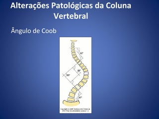 Alterações Patológicas da Coluna
Vertebral
Ângulo de Coob

 